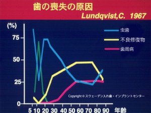 ハイジェニックデンチャー4