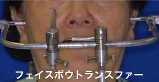 フェイスボウトランスファー